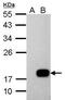 DCMP Deaminase antibody, PA5-34947, Invitrogen Antibodies, Western Blot image 
