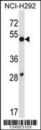Dual Specificity Phosphatase 9 antibody, 57-334, ProSci, Western Blot image 