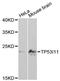 Tumor Protein P53 Inducible Protein 11 antibody, LS-C747925, Lifespan Biosciences, Western Blot image 