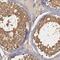 PBIP1 antibody, FNab05211, FineTest, Immunohistochemistry paraffin image 