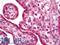 Ribosomal Protein Lateral Stalk Subunit P1 antibody, LS-C211030, Lifespan Biosciences, Immunohistochemistry paraffin image 