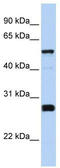 Family With Sequence Similarity 83 Member F antibody, TA340291, Origene, Western Blot image 
