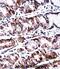 Protein Phosphatase With EF-Hand Domain 2 antibody, abx028033, Abbexa, Immunohistochemistry paraffin image 