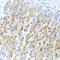 Activin A Receptor Type 1C antibody, 13-243, ProSci, Immunohistochemistry paraffin image 