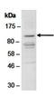 Zinc fingers and homeoboxes protein 2 antibody, orb66918, Biorbyt, Western Blot image 