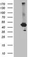 G Protein Subunit Alpha 14 antibody, LS-C796228, Lifespan Biosciences, Western Blot image 