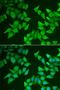 5'-Aminolevulinate Synthase 2 antibody, LS-C334774, Lifespan Biosciences, Immunofluorescence image 