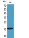 Persephin antibody, A13643, Boster Biological Technology, Western Blot image 