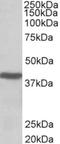 Acetyl-CoA Acetyltransferase 1 antibody, NBP1-46140, Novus Biologicals, Western Blot image 