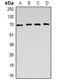 Very long-chain specific acyl-CoA dehydrogenase, mitochondrial antibody, abx225004, Abbexa, Western Blot image 