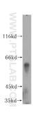 Dynactin Subunit 4 antibody, 17098-1-AP, Proteintech Group, Western Blot image 