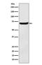 Solute Carrier Family 1 Member 1 antibody, M02367, Boster Biological Technology, Western Blot image 