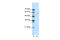 ETS Transcription Factor ELK1 antibody, 28-900, ProSci, Western Blot image 