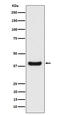 ERLIN2 antibody, M07042, Boster Biological Technology, Western Blot image 