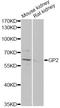 Pancreatic secretory granule membrane major glycoprotein GP2 antibody, LS-C747540, Lifespan Biosciences, Western Blot image 