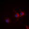 ATR Serine/Threonine Kinase antibody, orb74495, Biorbyt, Immunofluorescence image 