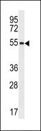 Zinc Finger Protein 621 antibody, 59-919, ProSci, Western Blot image 