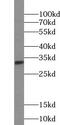UL16 Binding Protein 2 antibody, FNab09250, FineTest, Western Blot image 