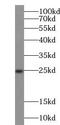 Superoxide Dismutase 2 antibody, FNab08104, FineTest, Western Blot image 