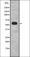 G Protein-Coupled Receptor Kinase 1 antibody, orb337135, Biorbyt, Western Blot image 