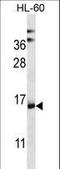 NADH:Ubiquinone Oxidoreductase Complex Assembly Factor 4 antibody, LS-C164804, Lifespan Biosciences, Western Blot image 