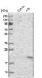Jumping Translocation Breakpoint antibody, NBP1-81746, Novus Biologicals, Western Blot image 
