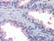 3-Hydroxybutyrate Dehydrogenase 1 antibody, abx010455, Abbexa, Enzyme Linked Immunosorbent Assay image 