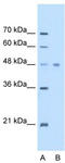 Eukaryotic Translation Elongation Factor 1 Alpha 1 antibody, TA346546, Origene, Western Blot image 