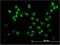 FIP antibody, H00007392-M03, Novus Biologicals, Immunofluorescence image 