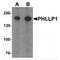 PH Domain And Leucine Rich Repeat Protein Phosphatase 1 antibody, MBS151247, MyBioSource, Western Blot image 