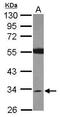 Short Chain Dehydrogenase/Reductase Family 16C Member 5 antibody, GTX119280, GeneTex, Western Blot image 
