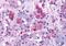 Arginine Vasopressin Receptor 1B antibody, MBS243796, MyBioSource, Immunohistochemistry paraffin image 