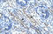 Ankyrin Repeat Domain 11 antibody, 27-884, ProSci, Immunohistochemistry paraffin image 