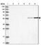 Required For Meiotic Nuclear Division 1 Homolog antibody, NBP1-90033, Novus Biologicals, Western Blot image 