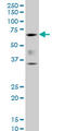 Cbfa1 antibody, LS-B4296, Lifespan Biosciences, Western Blot image 
