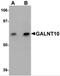 Polypeptide N-Acetylgalactosaminyltransferase 10 antibody, 5279, ProSci, Western Blot image 