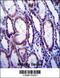 Collagen Type I Alpha 1 Chain antibody, 57-762, ProSci, Immunohistochemistry paraffin image 
