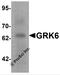 G Protein-Coupled Receptor Kinase 6 antibody, 7641, ProSci Inc, Western Blot image 