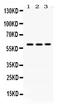 Recombination Activating 2 antibody, PB9793, Boster Biological Technology, Western Blot image 