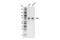 Peptidyl Arginine Deiminase 2 antibody, 97647S, Cell Signaling Technology, Western Blot image 