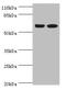 Spermatogenesis Associated Serine Rich 2 Like antibody, LS-C379496, Lifespan Biosciences, Western Blot image 