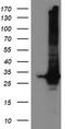 Glutathione S-Transferase Theta 2 (Gene/Pseudogene) antibody, TA501832, Origene, Western Blot image 
