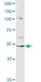 Protein Phosphatase 2 Regulatory Subunit Bbeta antibody, H00005521-M02, Novus Biologicals, Immunoprecipitation image 