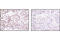 DFS 70 antibody, 2088S, Cell Signaling Technology, Immunohistochemistry paraffin image 