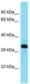 Uncharacterized protein C3orf54 antibody, TA334892, Origene, Western Blot image 