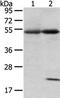 Syntrophin Alpha 1 antibody, CSB-PA100755, Cusabio, Western Blot image 