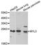 Myosin Light Chain 3 antibody, A6662, ABclonal Technology, Western Blot image 
