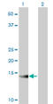 ATPase H+ Transporting V1 Subunit G2 antibody, LS-C196723, Lifespan Biosciences, Western Blot image 