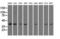 3-Hydroxyisobutyryl-CoA Hydrolase antibody, LS-C115318, Lifespan Biosciences, Western Blot image 