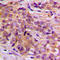 Centrosomal Protein 170 antibody, LS-C354602, Lifespan Biosciences, Immunohistochemistry frozen image 